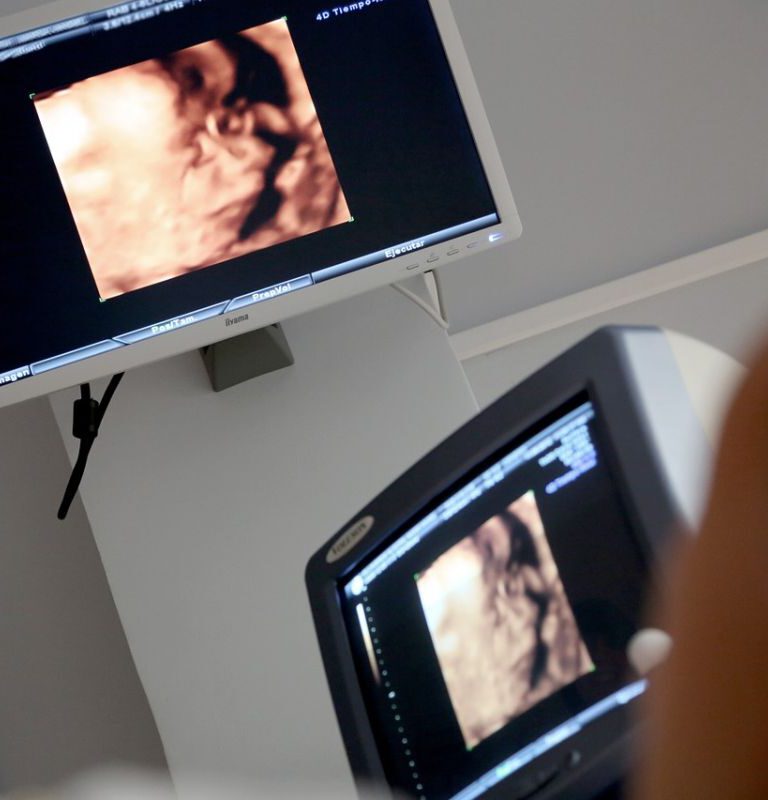 Ultrasonografia – co warto wiedzieć?